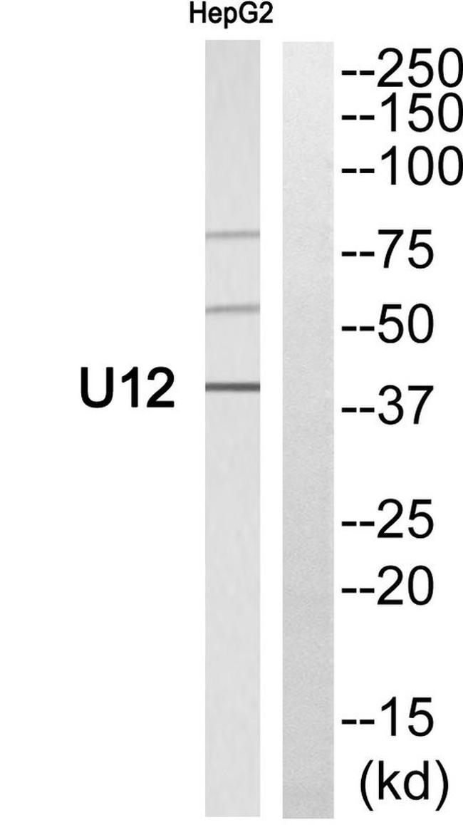 HHV-7 U12 Antibody in Western Blot (WB)
