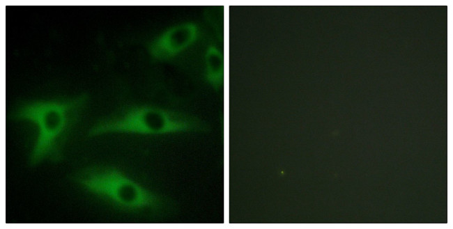 COL1A2 Antibody in Immunocytochemistry (ICC/IF)