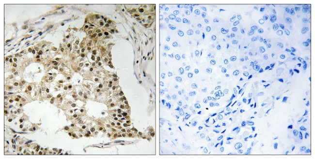 Phospho-RARA (Ser77) Antibody in Immunohistochemistry (Paraffin) (IHC (P))