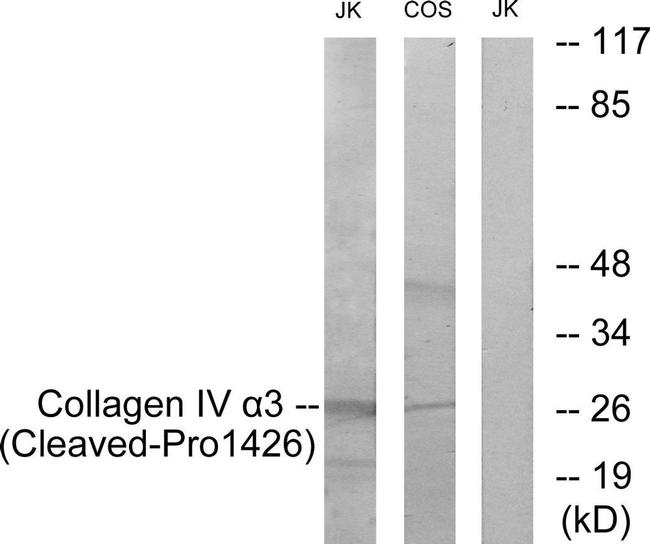 COL4A3 (Cleaved Pro1426) Antibody in Western Blot (WB)