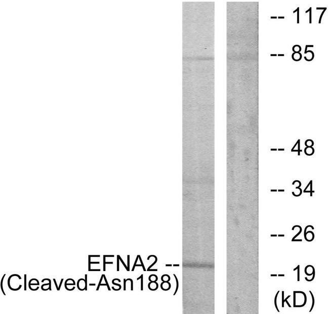 Ephrin A2 (Cleaved Asn188) Antibody in Western Blot (WB)