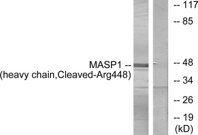 MASP1 (Cleaved Arg448) Antibody in Western Blot (WB)