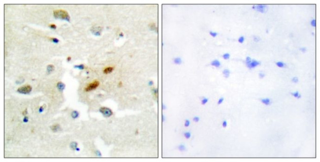REV3L Antibody in Immunohistochemistry (Paraffin) (IHC (P))