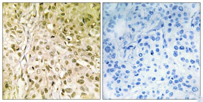 POLQ Antibody in Immunohistochemistry (Paraffin) (IHC (P))