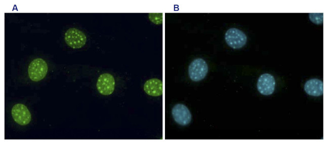 H3K9me3 Antibody in Immunocytochemistry (ICC/IF)