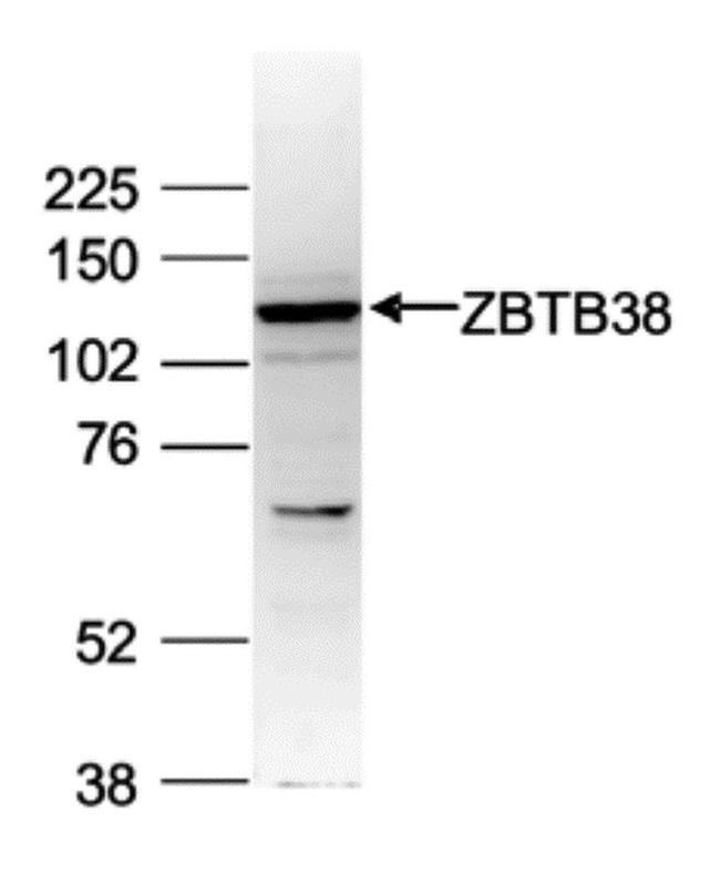ZBTB38 Antibody in Western Blot (WB)