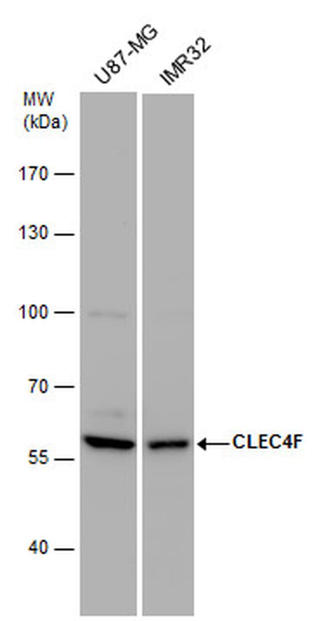 CLEC4F Antibody in Western Blot (WB)