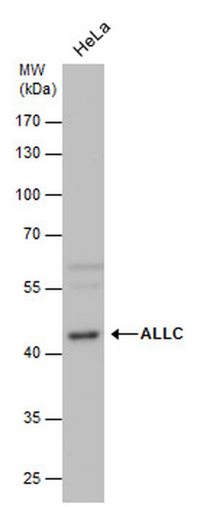 ALLC Antibody in Western Blot (WB)