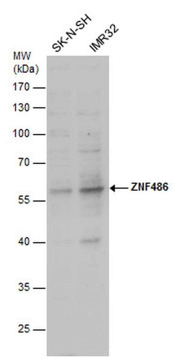ZNF486 Antibody in Western Blot (WB)