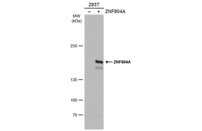 ZNF804A Antibody in Western Blot (WB)