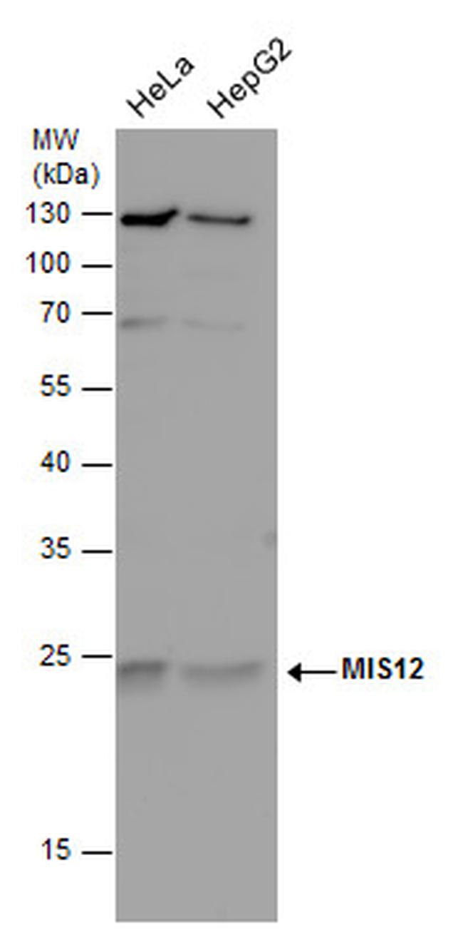 MIS12 Antibody in Western Blot (WB)