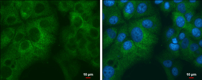 RPL32 Antibody in Immunocytochemistry (ICC/IF)