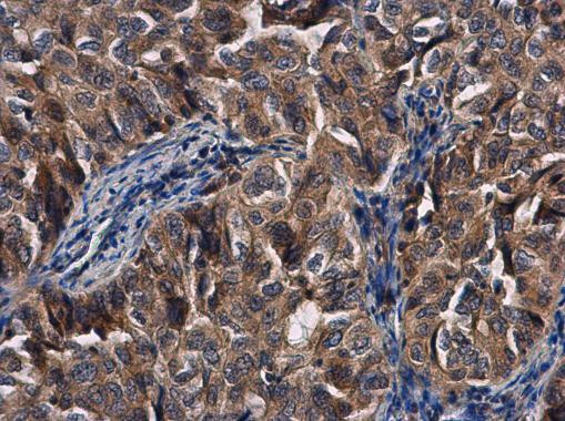 TDRD1 Antibody in Immunohistochemistry (Paraffin) (IHC (P))