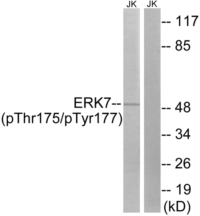 Phospho-MAPK15 (Thr175, Tyr177) Antibody in Western Blot (WB)