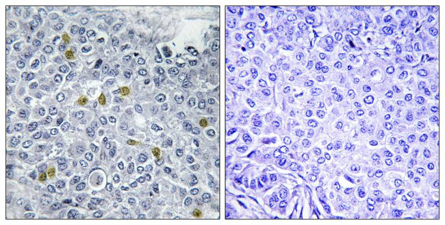 Phospho-TOP2A (Ser1106) Antibody in Immunohistochemistry (Paraffin) (IHC (P))