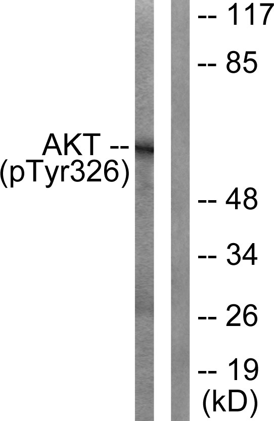 Phospho-AKT1 (Tyr326) Antibody in Western Blot (WB)