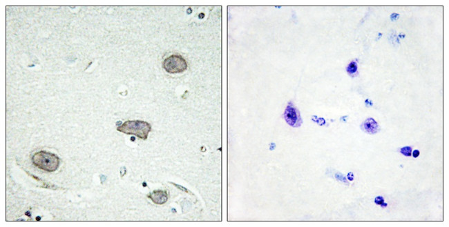 Phospho-CSF1R (Tyr809) Antibody in Immunohistochemistry (Paraffin) (IHC (P))