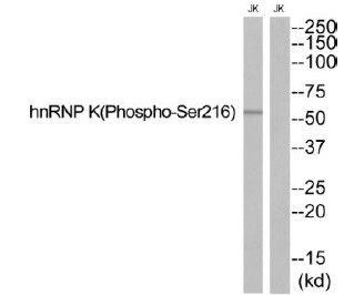 Phospho-hnRNP K (Ser216) Antibody in Western Blot (WB)