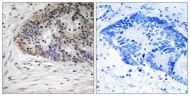 Phospho-MDMX (Ser367) Antibody in Immunohistochemistry (Paraffin) (IHC (P))