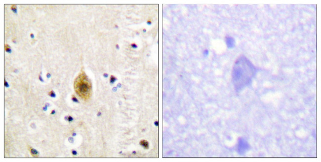 Phospho-MST1 (STK4) (Thr183) Antibody in Immunohistochemistry (Paraffin) (IHC (P))