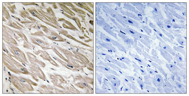 Phospho-PPP1R2 (Ser120, Ser121) Antibody in Immunohistochemistry (Paraffin) (IHC (P))
