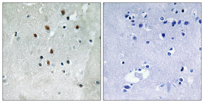 Phospho-SRF (Ser77) Antibody in Immunohistochemistry (Paraffin) (IHC (P))