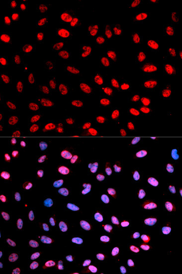 Phospho-Separase (Ser1126, Ser801) Antibody in Immunocytochemistry (ICC/IF)