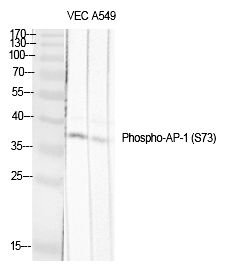 Phospho-c-Jun (Ser73, Ser100) Antibody in Western Blot (WB)