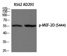Phospho-MEF2D (Ser444) Antibody in Western Blot (WB)