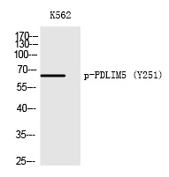 Phospho-PDLIM5 (Tyr251) Antibody in Western Blot (WB)