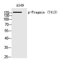 Phospho-SGK223 (Tyr413) Antibody in Western Blot (WB)