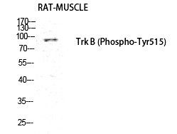 Phospho-TrkB (Tyr516) Antibody in Western Blot (WB)