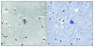 Phospho-OPRK1 (Ser369) Antibody in Immunohistochemistry (Paraffin) (IHC (P))