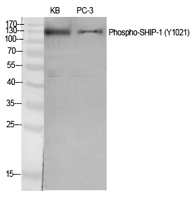 Phospho-SHIP1 (Tyr1021) Antibody in Western Blot (WB)