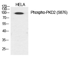 Phospho-PRKD2 (Ser876) Antibody in Western Blot (WB)