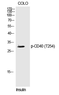 Phospho-CD40 (Thr254) Antibody in Western Blot (WB)