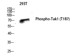 Phospho-TAK1 (Thr187) Antibody in Western Blot (WB)