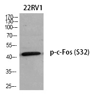 Phospho-c-Fos (Ser32) Antibody in Western Blot (WB)