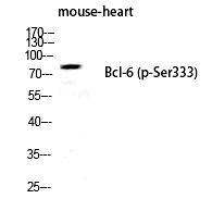 Phospho-Bcl-6 (Ser333) Antibody in Western Blot (WB)