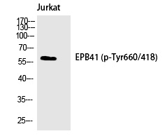 Phospho-EPB41 (Tyr660) Antibody in Western Blot (WB)