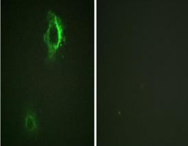 Phospho-CD5 (Tyr453) Antibody in Immunocytochemistry (ICC/IF)