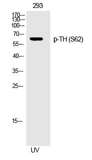 Phospho-Tyrosine Hydroxylase (Ser62) Antibody in Western Blot (WB)