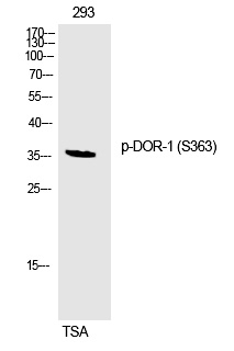 Phospho-OPRD1 (Ser363) Antibody in Western Blot (WB)
