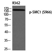 Phospho-SMC1 (Ser966) Antibody in Western Blot (WB)