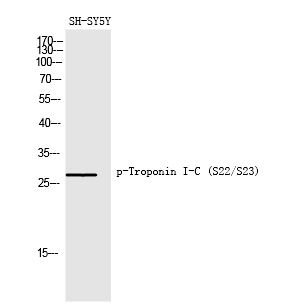 Phospho-Cardiac Troponin I (Ser22, Ser23) Antibody in Western Blot (WB)