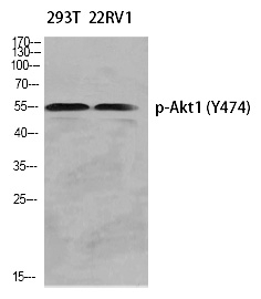Phospho-AKT1 (Tyr474) Antibody in Western Blot (WB)