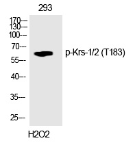 Phospho-MST1/MST2 (Thr183) Antibody in Western Blot (WB)