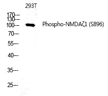 Phospho-NMDAR1 (Ser896) Antibody in Western Blot (WB)
