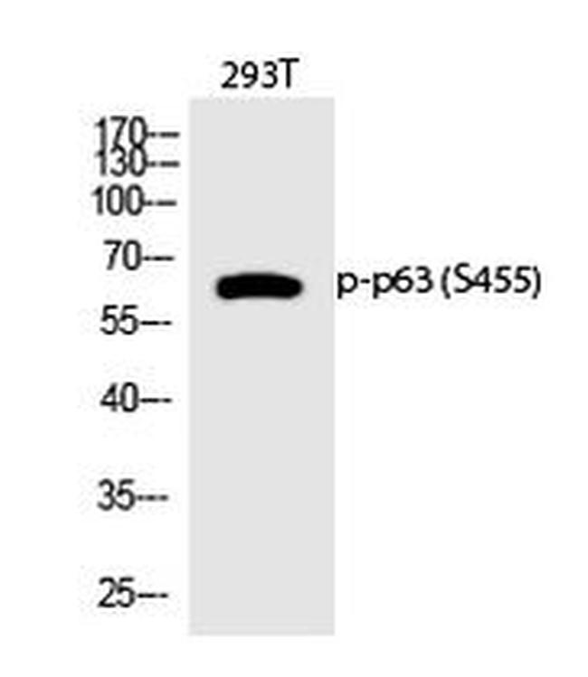 Phospho-p63 (Ser455) Antibody in Western Blot (WB)