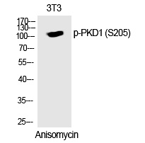 Phospho-PKC mu (Ser205) Antibody in Western Blot (WB)